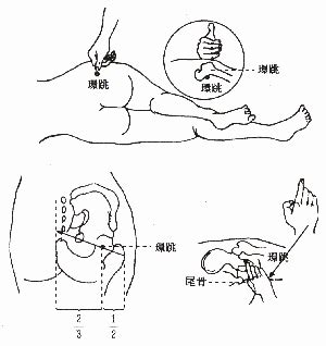 還跳穴|環跳穴可改善坐骨神經痛,腰腿痛,怕冷